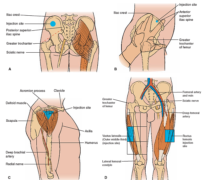 B12 Vitamin Store A Manual For You All What Are B12 Injections Where To Give B12 Injections Shots How To Give B12 Injections