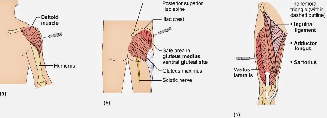 vitamin b12 injection sites