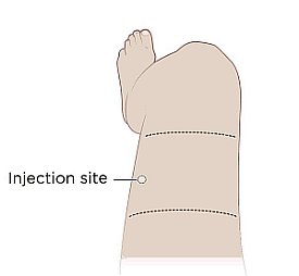 thigh injection site illustration
