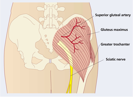 B12 Vitamin Store How To Give An Intramuscular Injection Of Vitamin B12