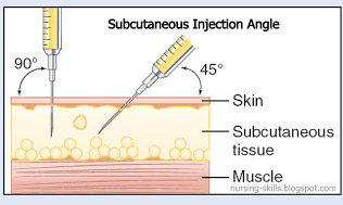 subcutaneous injection angles and location