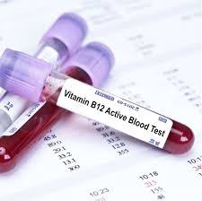 test tube with blood and sticker stating to test b12