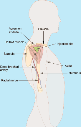 B12 vitamin Store How to inject B12 in your arm